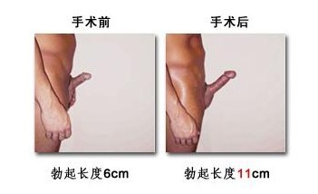 ӳҪǮ